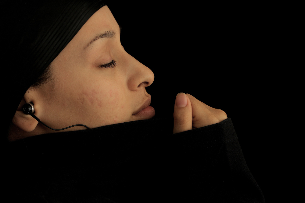 Acne & Acne Scar Treatment
