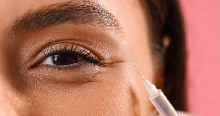 dermal filler