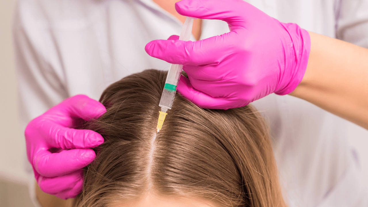 exosomes for hair restoration