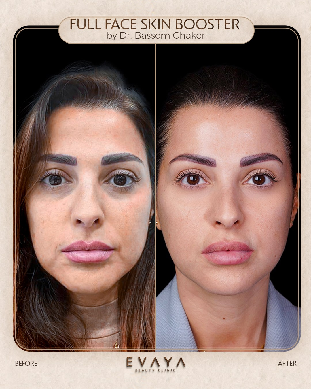 case-83-bassem-ba-evaya